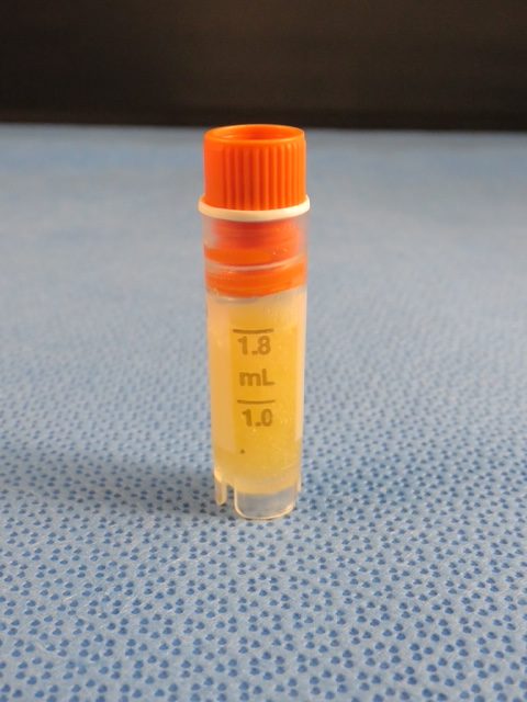 Lipoderma 1.5cc Vial - Image 4